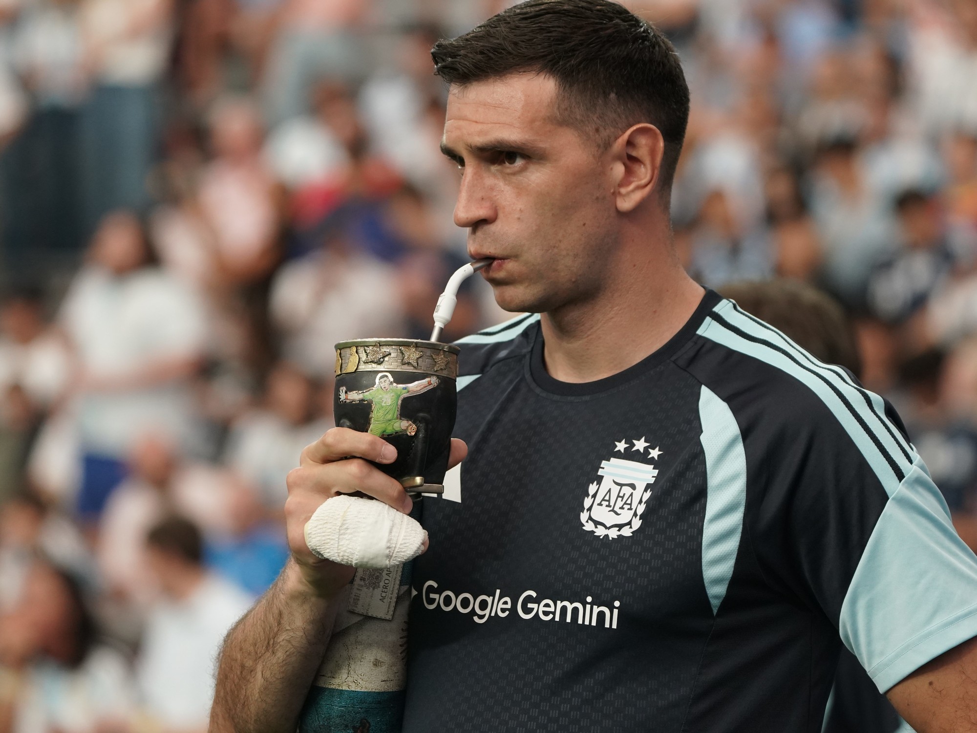 Emiliano 'Dibu' Martínez, Argentina's World Cup-winning goalkeeper, is seen training with his hand bandaged.